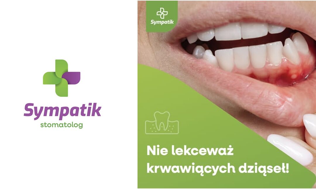 Krwawiące dziąsła – nie lekceważ❗️
