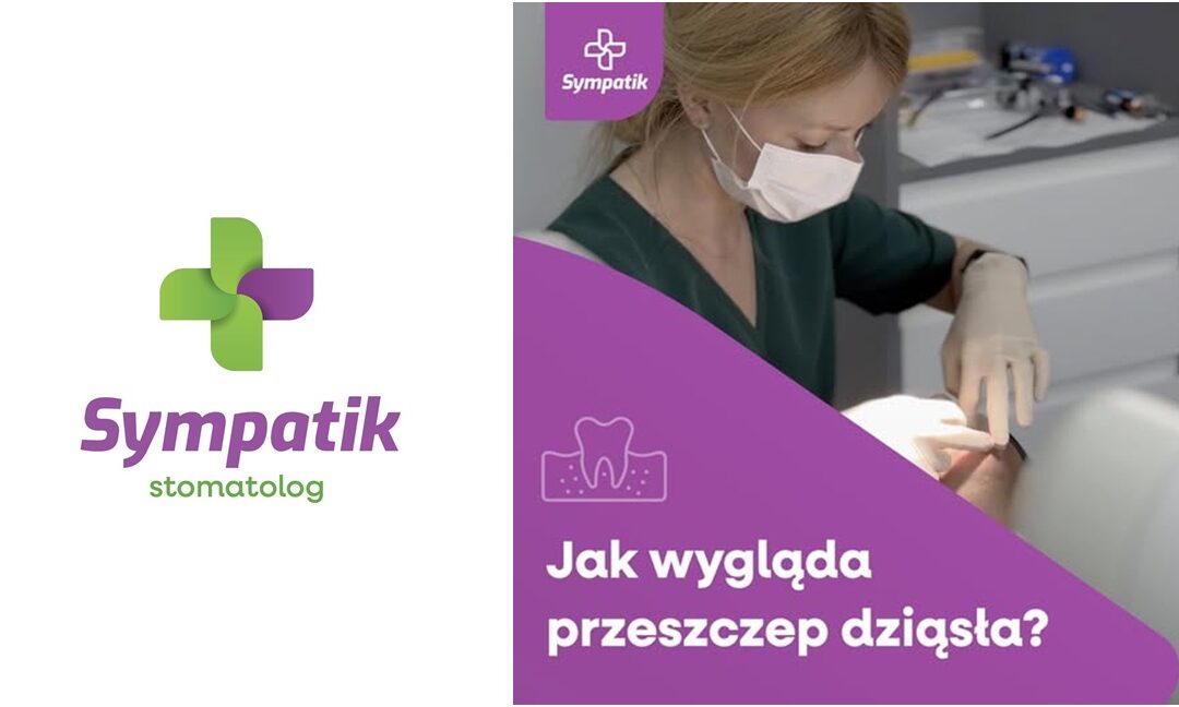 🦷 Przeszczep dziąsła – jak wygląda zabieg?