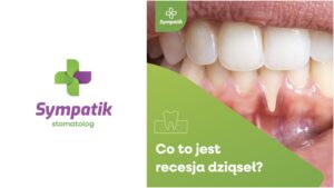 Recesja dziąseł – co to jest?