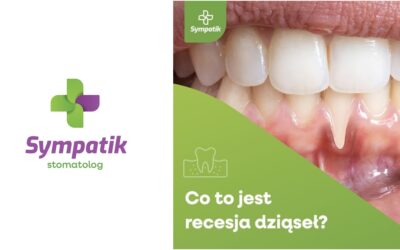 Recesja dziąseł – co to jest?