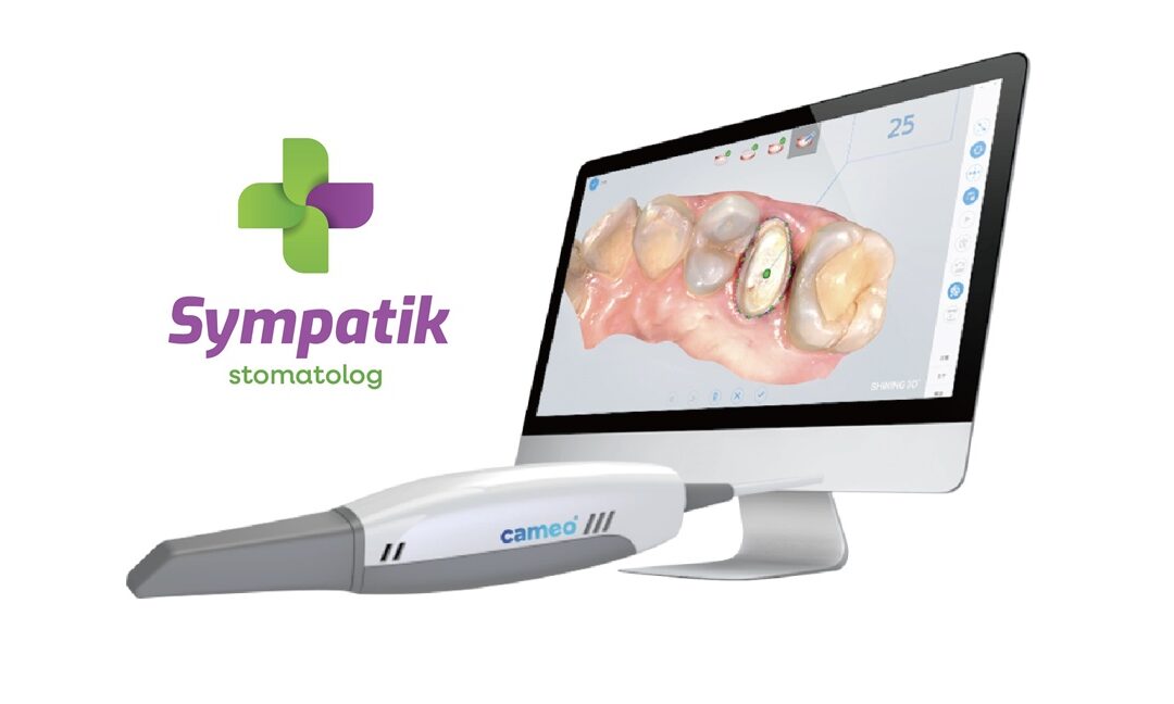 Wewnątrzustny skaner 3D CAMEO – znakomicie ułatwia leczenie!