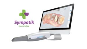 Wewnątrzustny skaner 3D CAMEO – znakomicie ułatwia leczenie!