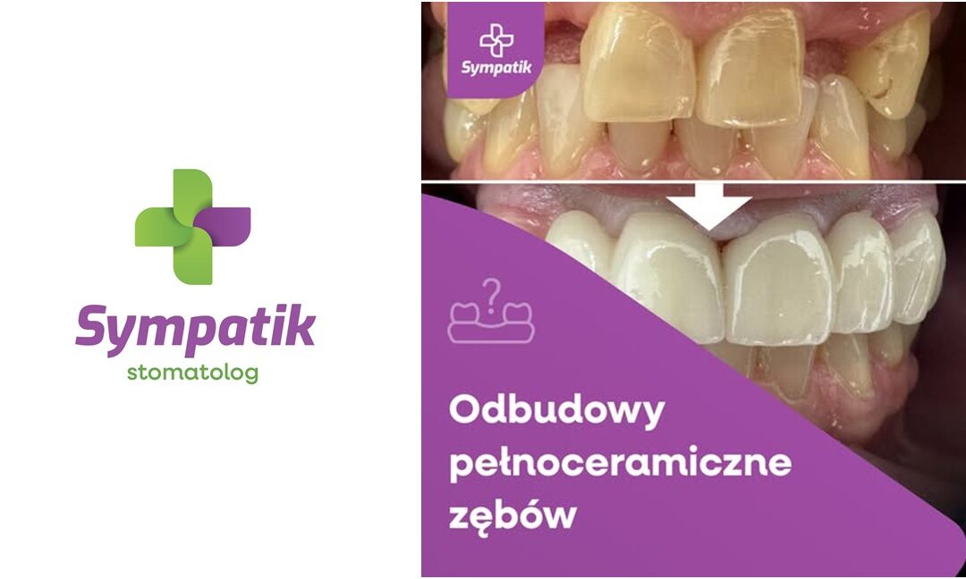 Metamorfozy Protetyczne Nasielsk | Odbudowy Pełnoceramiczne