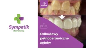 Metamorfozy Protetyczne Nasielsk | Odbudowy Pełnoceramiczne
