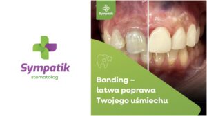 Piękny uśmiech bez długiego leczenia? Tak! Odkryj siłę Bondingu.