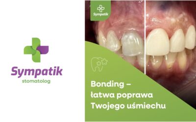 Piękny uśmiech bez długiego leczenia? Tak! Odkryj siłę Bondingu.