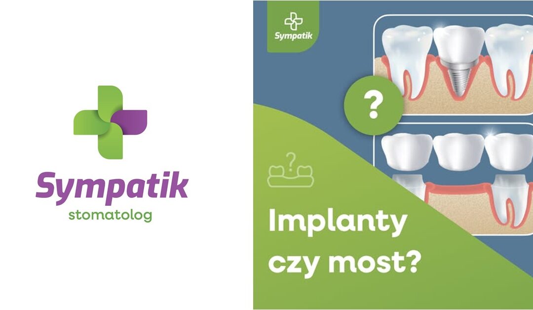 Implanty czy most w Nasielsku? Porównanie rozwiązań – Sympatik
