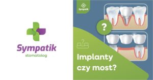 Implanty czy most w Nasielsku? Porównanie rozwiązań – Sympatik