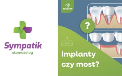Implanty czy most w Nasielsku? Porównanie rozwiązań – Sympatik