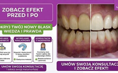 Profesjonalne wybielanie zębów w Nasielsku – odzyskaj blask swojego uśmiechu!