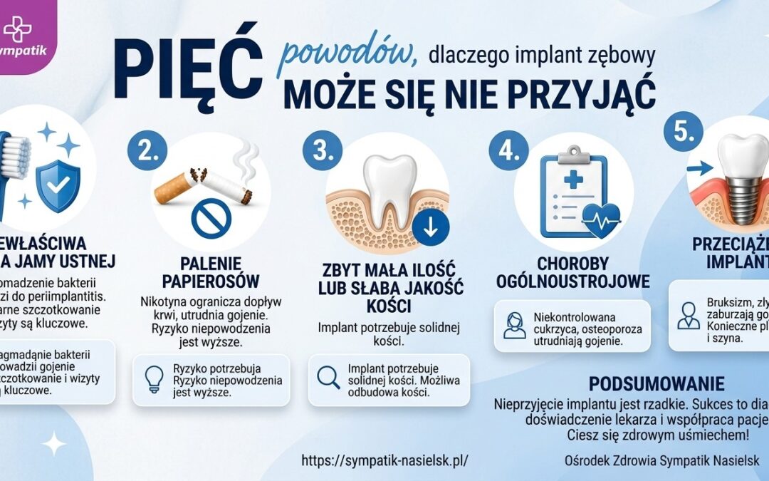 5 powodów, dlaczego implant zębowy może się nie przyjąć – co warto wiedzieć