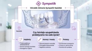 Czy istnieje uzupełnienie protetyczne na całe życie? | Sympatik Nasielsk